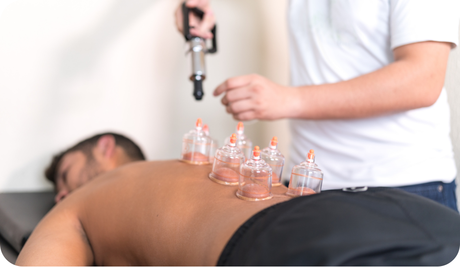 Cupping Therapy