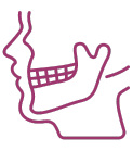 TMJ Dysfunction