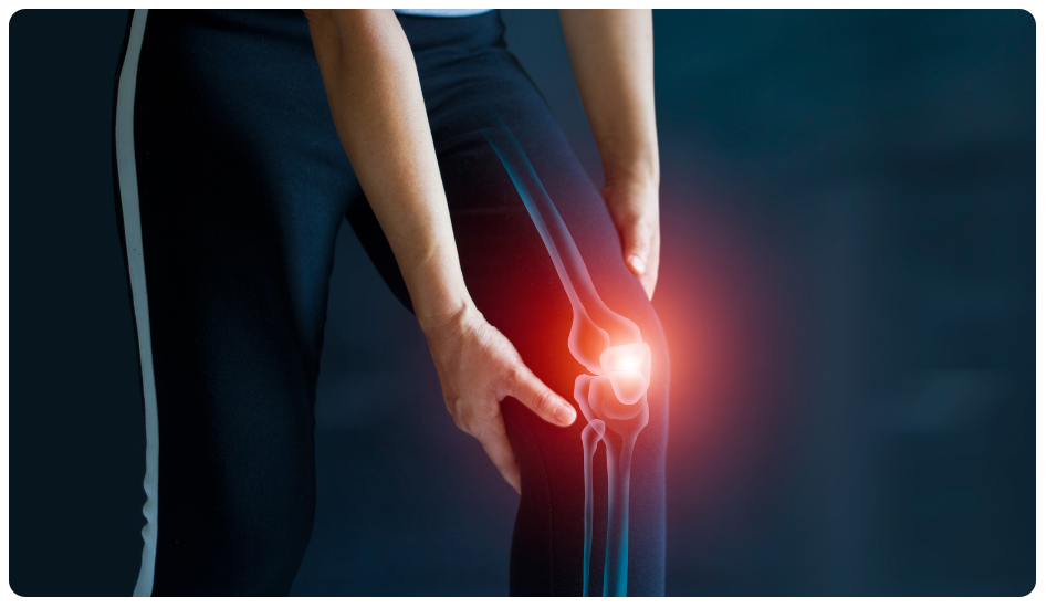 arthritis