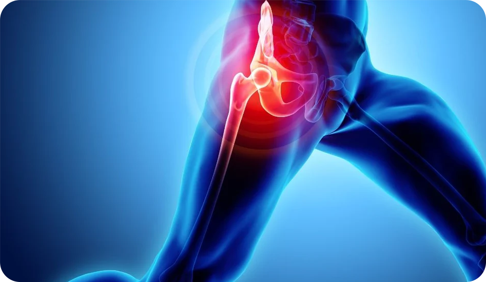 Hip Pain